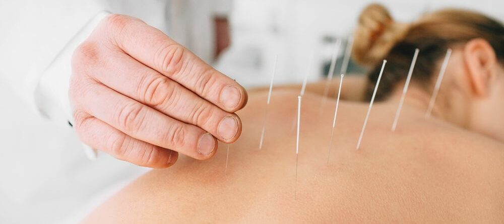 The Benefits of Acupuncture: Is It Right for You?